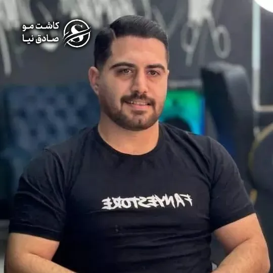 مشتری کاشت مو سه