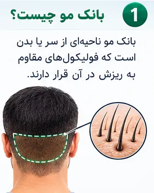 بانک مو چیست و چه نقشی در موفقیت کاشت مو دارد؟ (راهنمای کامل) 1 بانک مو چیست؟
