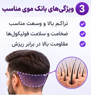 بانک مو چیست و چه نقشی در موفقیت کاشت مو دارد؟ (راهنمای کامل) 5 ویژگی بانک موی مناسب