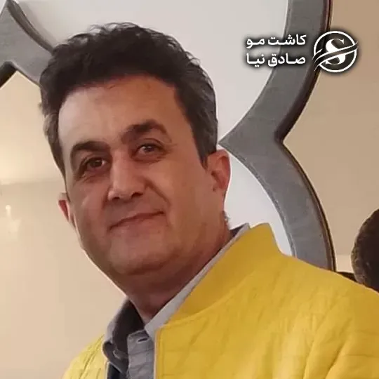 مشتری کاشت مو چهار