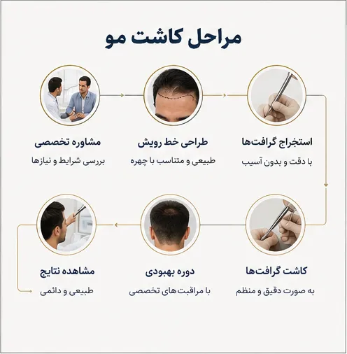 کاشت مو شیراز ۱۴۰۵| مشاوره رایگان، تجربه واقعی مراجعان + شرایط ویژه اقساط با خانم صادق نیا 5 مراحل کاشت مو در شیراز