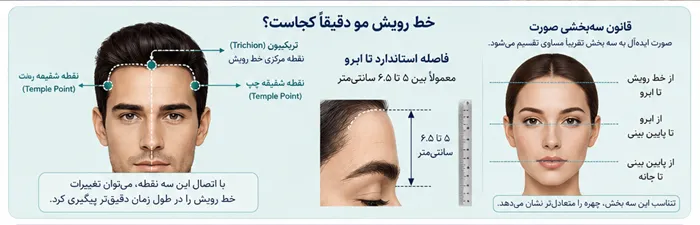 خط رویش مو کجاست؟