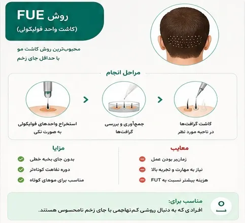 انواع روش کاشت مو | مقایسه کامل روشهای FUT، FUE، SUT و جدیدترین تکنیکها در ایران 5 روش کاشت مو fue در شیراز