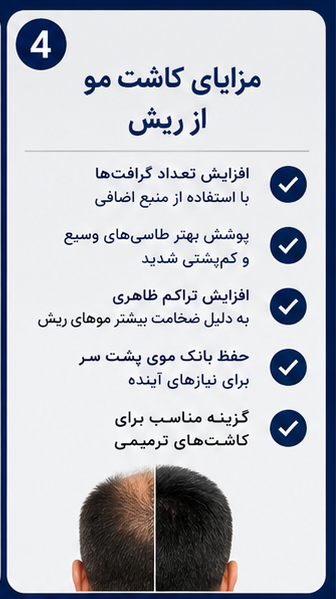 کاشت مو از ریش؛ راهکاری موثر برای افرادی با بانک موی محدود! 4 مزایای کاشت مو از ریش