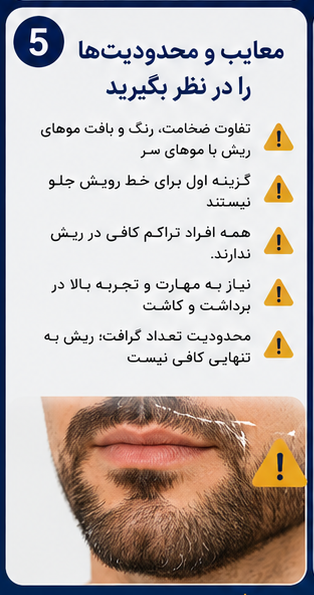 کاشت مو از ریش؛ راهکاری موثر برای افرادی با بانک موی محدود! 5 معایب و محدودیت های کاشت موی سر از ریش
