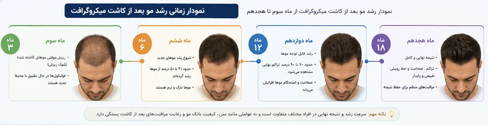 کاشت مو میکروگرافت در شیراز | بررسی تخصصی، روش انجام 7 مرحلهای، مقایسه و تصمیمگیری 6 نمودار زمانی کاشت مو میکروگرافت