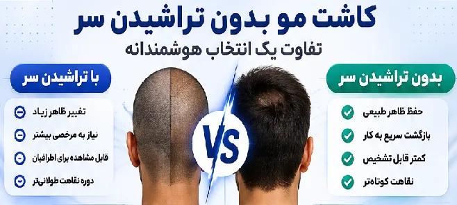 کاشت مو بدون تراشیدن سر در شیراز | آیا بدون اصلاح کامل مو میتوان کاشت انجام داد؟ 1 کاشت مو بدون تراشیدن سر