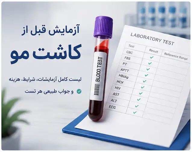 آزمایش قبل از کاشت مو؛ لیست کامل آزمایشهای ضروری + تفسیر جواب هر تست 1 آزمایش قبل از کاشت مو