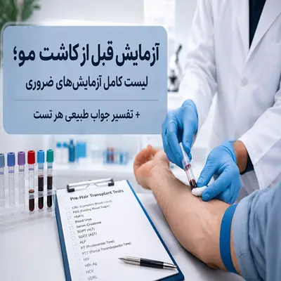 آزمایش‌های قبل از کاشت مو