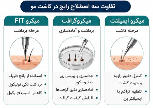 کاشت مو به روش میکرو FIT چیست؟ بررسی 5 مرحله روش و تفاوت با FIT معمولی 2 تفاوت سه اصطاح رایج در کاشت مو FIT