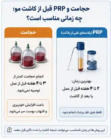 حجامت و پی آر پی قبل کاشت مو