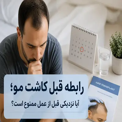 رابطه قبل کاشت مو
