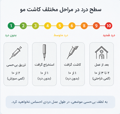 کاشت شقیقه با روش میکرو FIT در شیراز | کاشت مو شقیقه صادقنیا 5 سطح درد در مراحل مختلف کاشت شقیقه