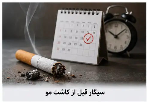 سیگار قبل از کاشت مو