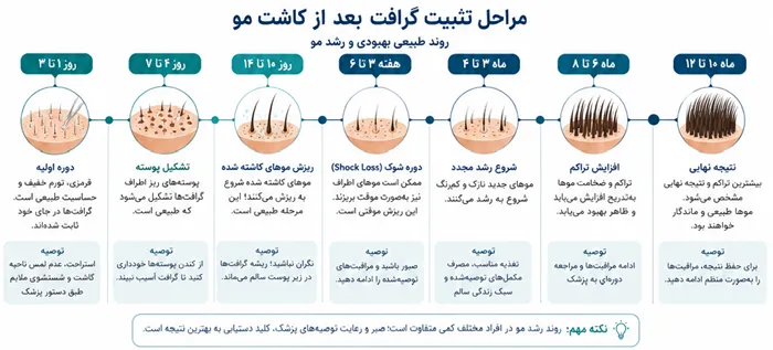گرافت مو چیست و حداکثر گرافت کاشت مو چقدر است؟ راهنمای علمی تعداد و هزینه! 3 مراحل تثبیت گرافت بعد از کاشت مو
