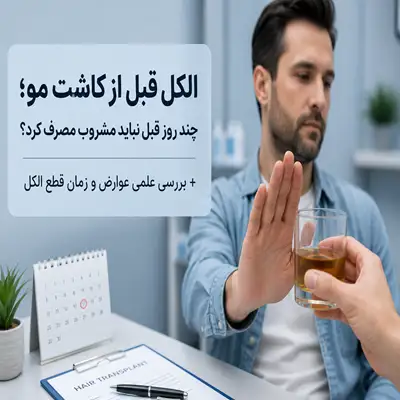 مصرف الکل قبل از کاشت مو