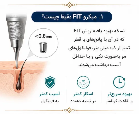 کاشت مو به روش میکرو FIT چیست؟ بررسی 5 مرحله روش و تفاوت با FIT معمولی 1 میکروFIT چیست؟