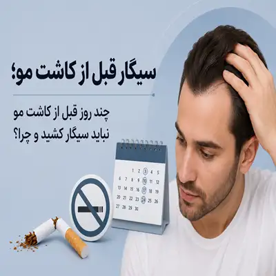 چند روز قبل از کاشت مو نباید سیگار کشید؟