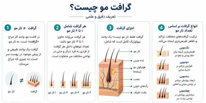 گرافت مو چیست و حداکثر گرافت کاشت مو چقدر است؟ راهنمای علمی تعداد و هزینه! 1 گرافت مو چیست؟